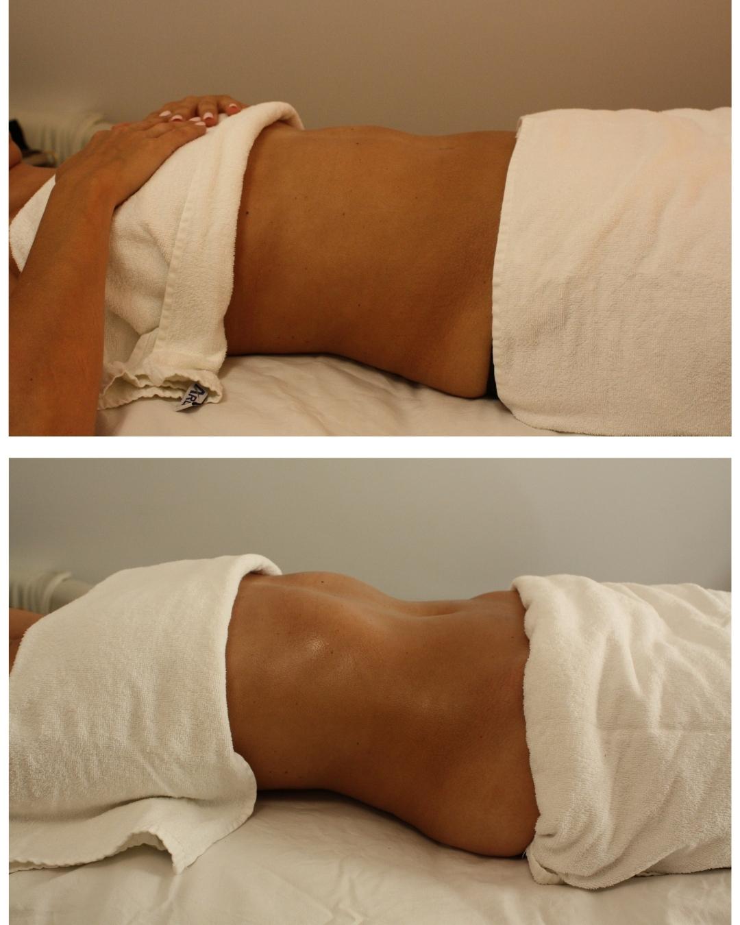 Kirk vorhernachher Bauch (1350 x 1080 px) (1080 x 1350 px)