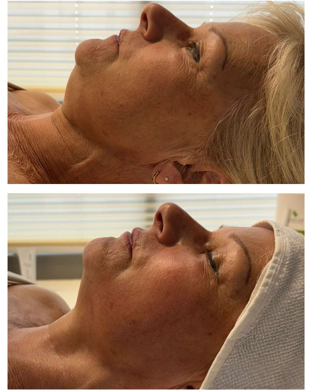 Sandra Kirk vorhernachher Bauch (1350 x 1080 1